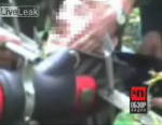 超衝撃映像-柵が顎から口へ貫通した男性の救出劇【観覧注意】